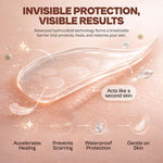 Close-up of acne patches for effective pimple healing